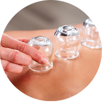 Soin Cupping